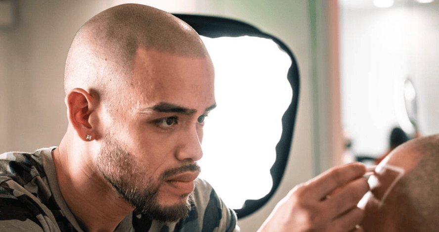 The best scalp micropigmentation practitioners The best scalp micropigmentation practitioners