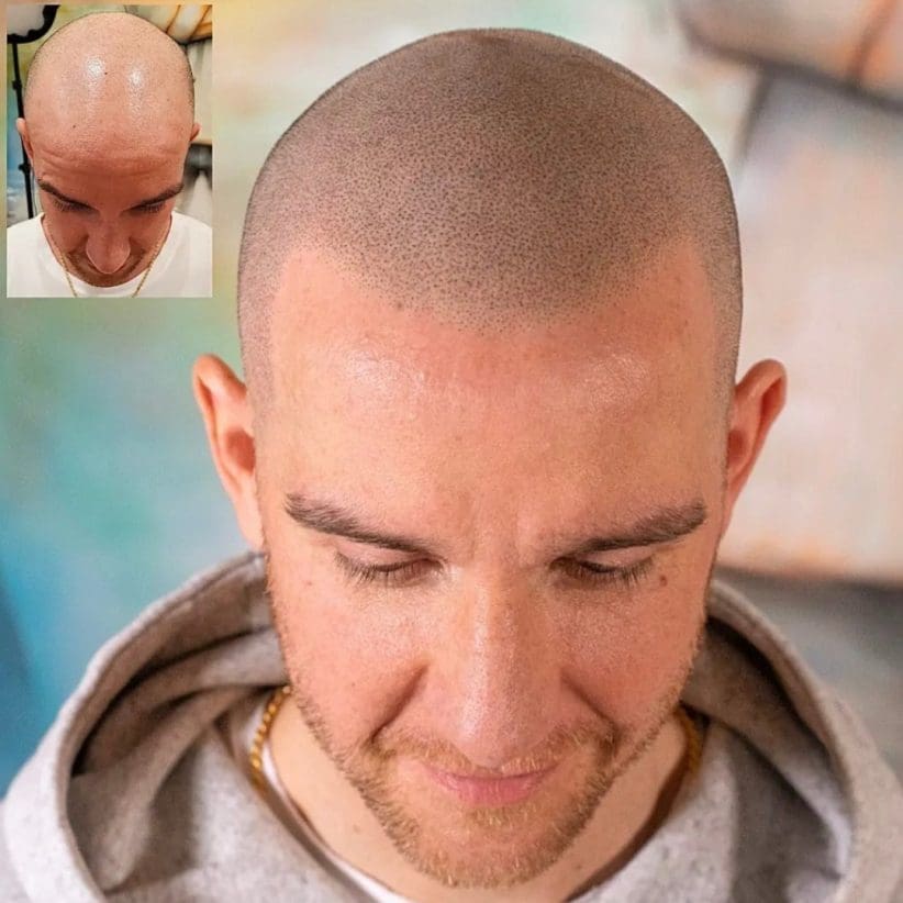 micro scalping