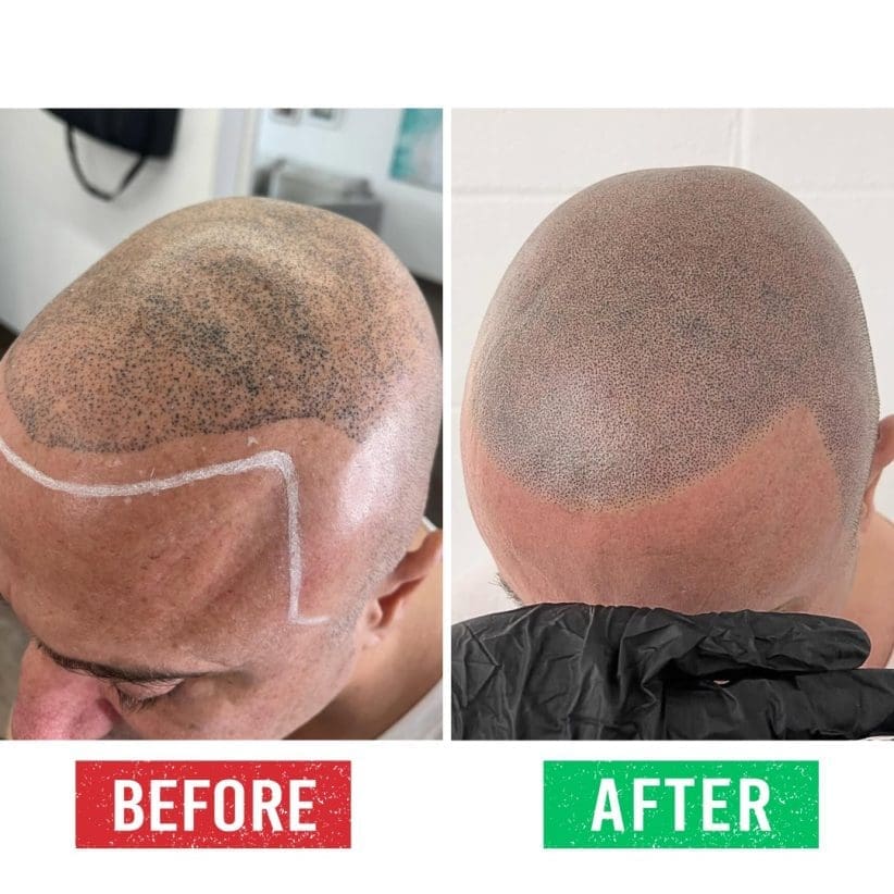 micropigmentation fix