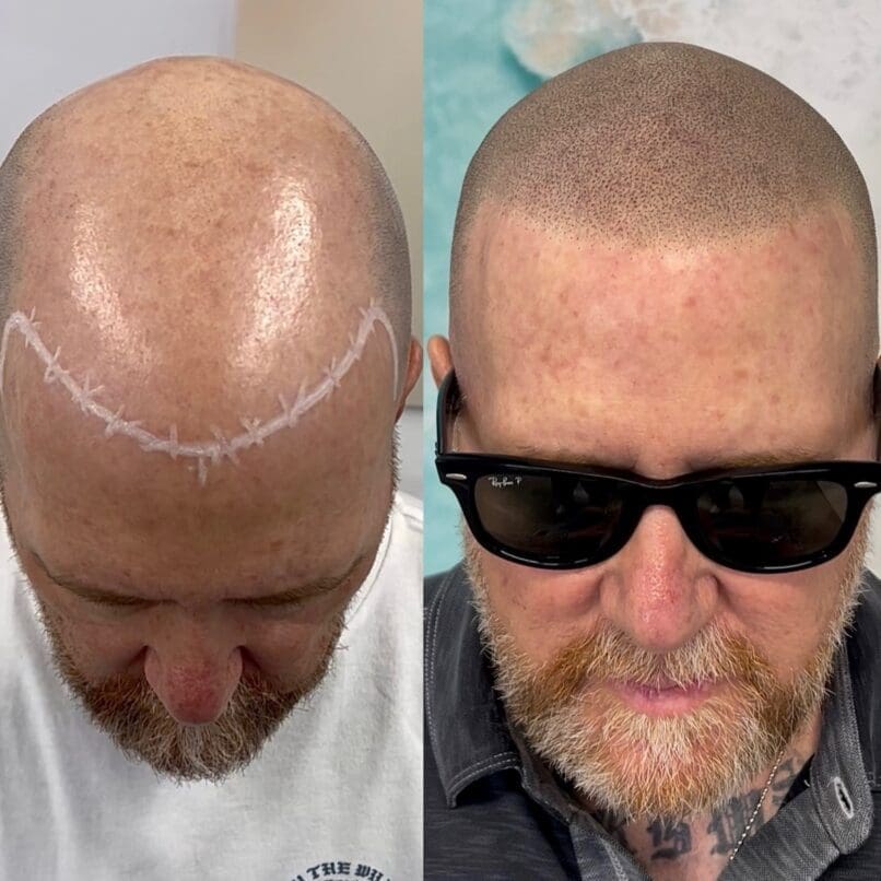 micropigmentation los angeles